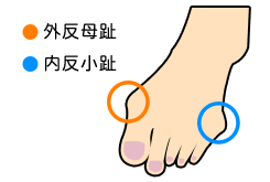 改善した患者