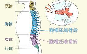 腰痛の原因